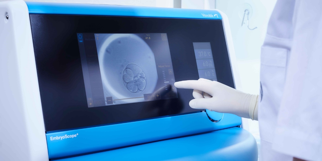 Embryoscope: How can it increase the chances of IVF success?
